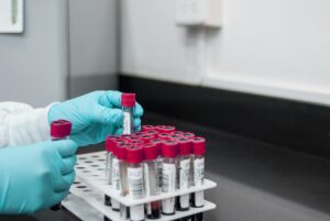 敏感肌の方がワキガ手術後に感じるかゆみの対処法は？